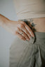 A women resting her hand on her hip, showing a ring
